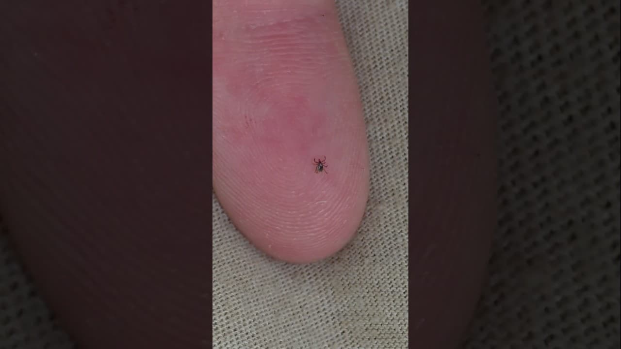 How I deal with ticks
