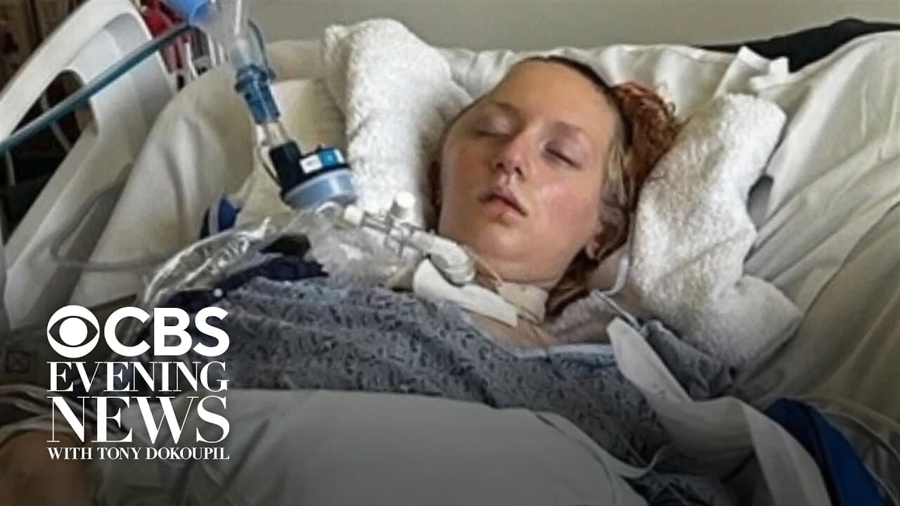 California Six Flags rollercoaster left more than 100 people with brain injuries, attorneys say