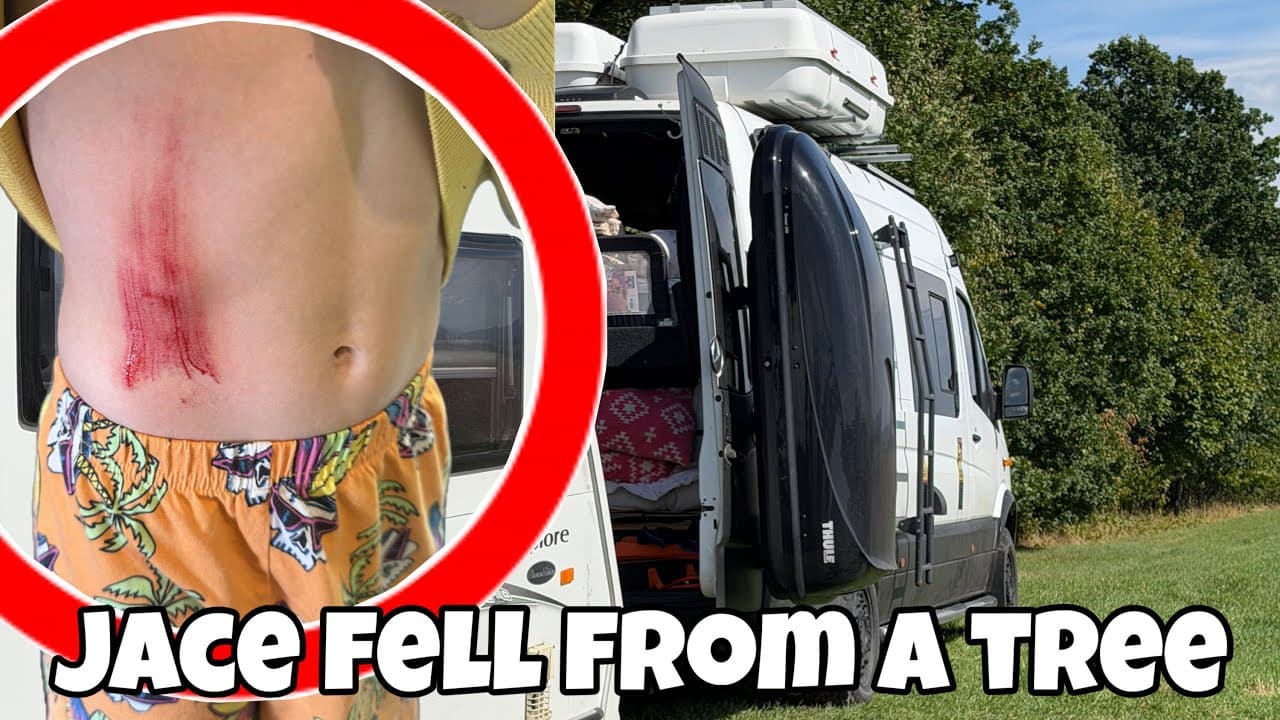 Jace Had a Nasty Accident Falling from a TREE!